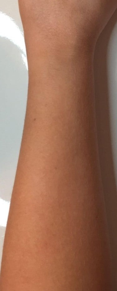 Before image